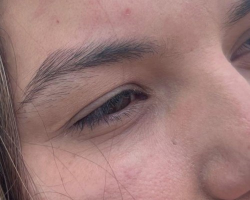 Mudando de lado