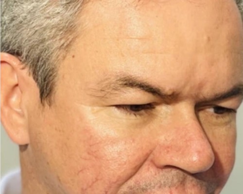 O Ministério público do Maranhão ingressou com uma ação de improbidade administrativa contra o Prefeito de Timon Raphael Leitoa